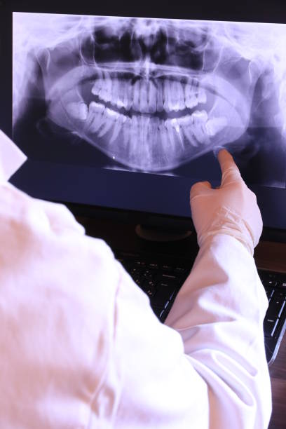 Best Emergency Root Canal Treatment in Mystic Island, NJ